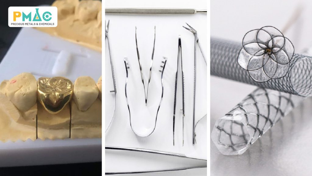 Ứng dụng của hóa chất xi mạ trong nha khoa